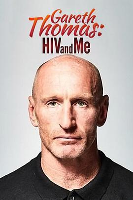 加雷斯·托马斯：HIV与我